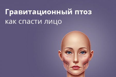Гравитационный птоз лица - причины, симптомы и лечение